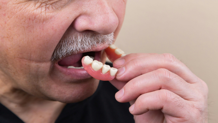 Are You a Candidate for Dental Implants?