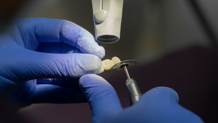 Basic Information About Dental Implant Cost