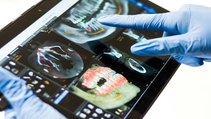 Why Are Dental Implants So Expensive?