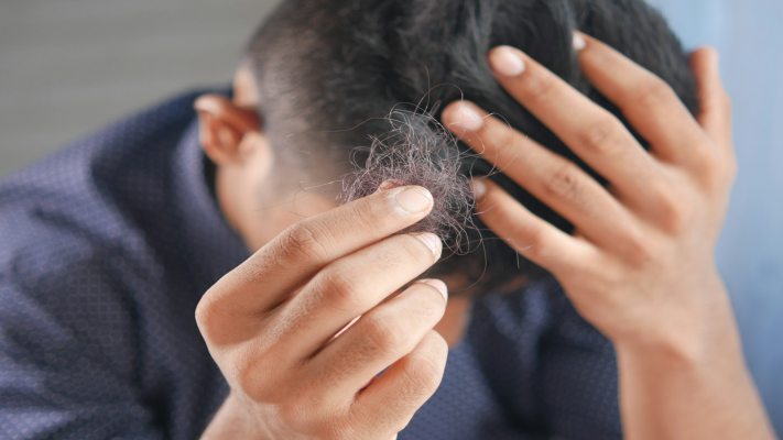 Excessive Hair Loss: Causes and Next Steps
