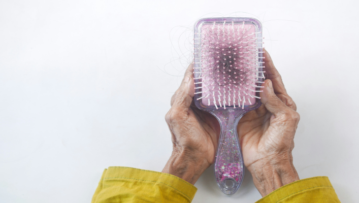 How to Address Hair Loss
