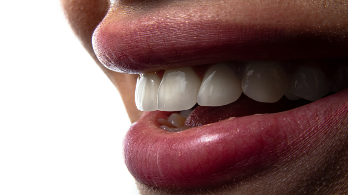 Tips for Better Dental Implant Outcomes